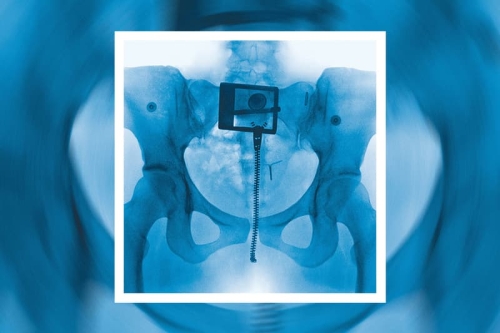 封面大公开!Lorde 全新专辑《Virgin》即将登场