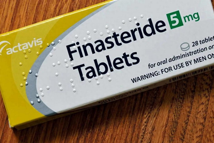 以色列专家近日发布评审报告:热门的脱发治疗药物非那雄胺与自杀行为存在关联